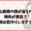 中山美穂の顔が違うのは頬肉が原因？現在の顔は若作りしすぎで別人？