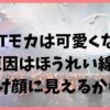 ILLITモカは可愛くない？原因はほうれい線で老け顔に見えるから？