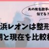 新浜レオンは整形してる？幼少期と現在を画像で比較し分かった事実！